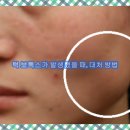 근이케이스 이미지