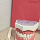 자연이바른치과의원 | 향남 상신리 치과, 앞니가 시려요... 원인은? [자연이바른치과의원]