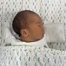 에스앤유서울병원 | 2개월 아기 종로 에스앤유 피부과ㅣ발목 이소성 몽고반점 레이저 치료