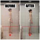 다나은한의원 | 일산체형교정 마사지 센터 더나은체형교정원, 좌골신경통 골반교정 후기