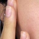 더마존 코리아 이미지
