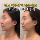 끌레르 - 포항시 북구 대곡로 5 | 광교 피부관리 슈퍼젝션 모공관리 내돈내산 후기 끌레르블랑