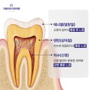 100년치과의원 | 미니쉬에 대해 알려드려요! (가격, 재료, 치아 삭제량, 보증기간)