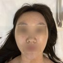 청주 피부관리 프리미엄ㅣ피부희망에스테틱ㅣ피부 MBTI 진단받은 후기