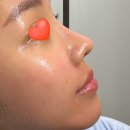 케이더마 이미지