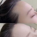 식사동 SK3단지버스정류장 | 일산 식사동 헤어라인 잘하는 곳 아이브 뷰티 : 헤어라인관리 추천 후기