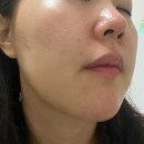 셀플렉스 | 모공앰플 주름케어에 효과가 좋은 루아셀 펩플렉스 에센스, 스파이크샷 앰플 추천 후기