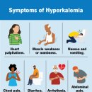 방실네국수 | 전해질 불균형 Hypokalemia 저칼륨혈증 Hyperkalemia 고칼륨혈증 정상범위 EKG 원인 증상 치료 식이요법