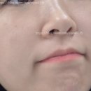 청담서울여성외과의원 | 청담피부과 청담루틴의원 BBL레이저 후기 피부톤 칙칙함 관리