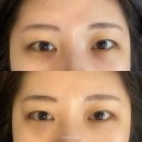 지에스(GS)25 대봉서한점 | 대구 다크서클 전문 관리 자극 없이 자연스러운 대봉동 뮤롬 솔직 후기