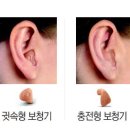 라파보청기 이미지