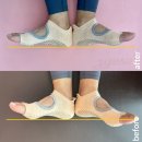 [보니따필라테스 청주 율량점] 🧘‍♀️어깨 비대칭 & 골반 불균형 교정 성공 후기💪