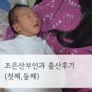 38 | 남양주 평내조은산부인과 38주 제왕절개/출산비용/더마본드/출산가방리스트/초산,경산 출산후기