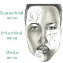 ■ 피부 봉합(skin suture) 시술에서의 주의 사항 이미지