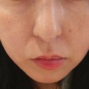 힐비뇨기과의원 이미지