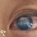 좋은의안 이미지