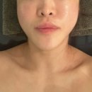 미소야 명일점 | 명일동피부관리 고덕동 샤샤에스테틱 강동구윤곽관리 잘하는곳