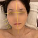레메디 | 구로 신도림 여름 피부관리 윤곽 리프팅 엘뷰티 레메디 여름 프로모션 솔직후기