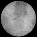 바로튼튼신경외과의원 이미지