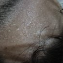 미라클효소찜질 이미지