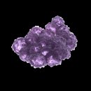 대세포차 | [전문의 칼럼] 가슴보형물 제거/교체 동시에 가능한 경우와 안되는 경우