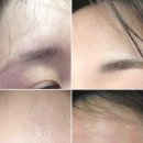 좁쌀여드름 없애기 디콕트 오트 티트리 수딩 크림