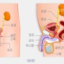 전립선암의 일반적인 증상 이미지