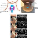Anterior neck sonographic landmarks 이미지