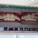 석촌호수치과의원 네이버블로그
