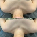 신창동피부관리 이반랩 복부순환최고 똥배관리 캐비원 후기