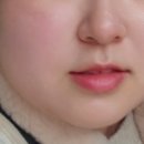 르에이치의원