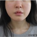 강남연세라인의원 이미지