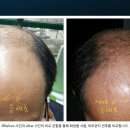 코디헤어 이미지