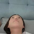 귀족수술 2개월차 후기 |중안부 볼륨 채우니 어려보인다는 말 들은 내돈내산 후기