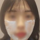 바른빛피부과의원 | 피부과 밴스란힐러 스킨부스터 내돈내산 후기, 통증 리쥬란힐러 효과 엠보 자국 (+사진 추가 예정...