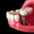 서울덴토피아치과의원 이미지