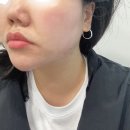 윤슬한의원 | 창원 다이어트 한의원 "윤슬환" 일주일 체험 후기