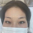 모이빈부티크(Moi:Been) | 부평자연눈썹 모이빈부티크에서 무통 반영구로 예뻐지자