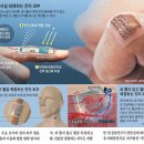 피부를바꾸다 이미지