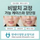 한문대학 | 비발치 교정 가능 케이스와 장단점, 실제 전후 후기 비교
