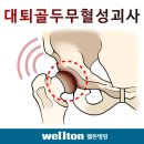 대표적인 고관절통증의 통증원인에 대해 알아볼까요~^^ 이미지