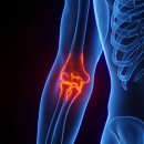 칠성보강정형외과의원 이미지