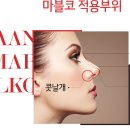 마블성형외과의원 | 리프팅 마블코 잘하는곳 강남역 성형클리닉!