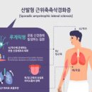 루게릭병 진단 원인 증상 유전 될까 이미지