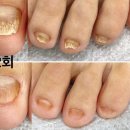 은영네일