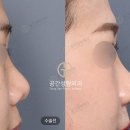 케이스코 이미지