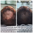 정수리두피문신 잘하는 리턴 의원에서 공부하기