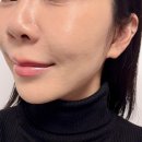 벨피부과의원 이미지