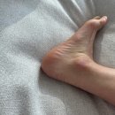 금천구발각질 미모네일 동성제약 풀리메디 금천점 발각질 후기