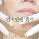 버닝썬 | 안산 고잔동 팔자주름 피부관리 효과 탁월한 깨끗한피부나라 버닝필 후기